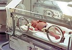 Thumbnail for Neonatal intensive care unit