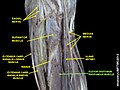 Flexor digitorum profundus muscle