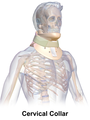 Cervical collar