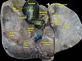 Cystic duct.Visceral surface of liver.