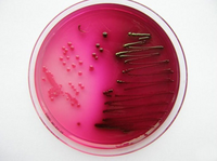 E. coli auf Endo-Agar mit deutlich sichtbarem Fuchsinglanz