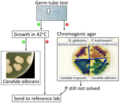 Algorithm for the diagnosis of Candida albicans versus differential diagnoses