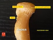 Radius, radial head – posterior view